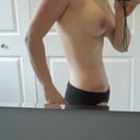 Day 20 Post Op