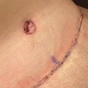 Close up of belly button. Does that look normal? It looks huge...