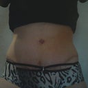 13 days, Low cut undies. Not looking sexy at all!