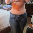 2013 - 1 yr 9 mo post TT & 9 mo post scar revision.  1/1/13 - I know some ladies don't like hips but I LOVE my hourglass shape!!  Keeping my hips was a must!