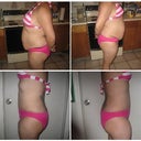 before surgery and 7 weeks after sides