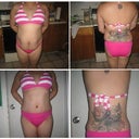 before surgery and 7 weeks after front and back