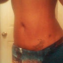 3 weeks post op