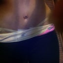 6 day p.o. the scar on my hips are a little higher than id like them to be..the very ending comes out about to how high my belly button is and i do not wear my pants that swooped, mostly straight.