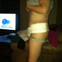 From the side. Looks pretty flat. Just waiting to heal!