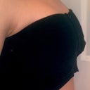 DAY 11: Same black bra that was issued to me on day 1, right after surgery, DEFINITELY can see changes from then and now :)