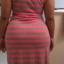 day 1 postop...no garments or underwear.