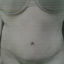 I love my new tummy! Side Fat gotta with BBL