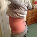 Before surgery