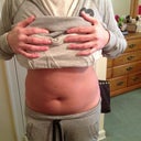 Before surgery