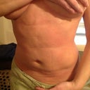 4weeks post op