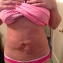 8weeks see the lumpiness