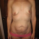 Yuck!!  I can't wait to look in the mirror and not have to see this anymore!!