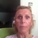 day 6  almost finished peeling,  skin is  tighter,,wrinkles are smoother...