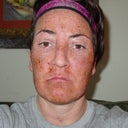 hours after the surgery