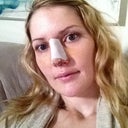 Post-op, day five.