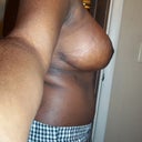3wks 4days post op