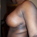 3wks 4days post op