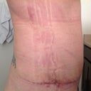 Week 4 side