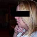 neck before (New Years so 3.5 months ago)