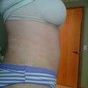 stomach after 1 week