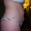 stomach day before surgery