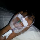 My IV before surgery