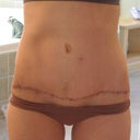 5 months and 5 days po