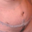 day 11 alil swollen still but theres a close up lol