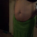3 months pre-op, before weight loss. Weight 174
