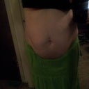 3 months pre-op, before weight loss. Weight 174