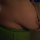 3 months pre-op, before weight loss. Weight 174