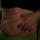 3 months pre-op, before weight loss. Weight 174