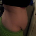 3 months pre-op, before weight loss. Weight 174