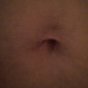 3 months pre-op, before weight loss. Weight 174