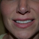 3 months notice my teeth were fixed too!