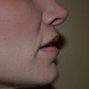 3 months