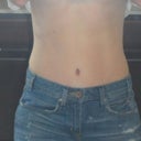 3 months and finally able to wear my pre-tt jeans. Woo Hoo!