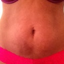Day before procedure