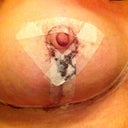 close up 3 days post op