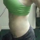 Six and a half weeks post op