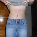 4 weeks post op