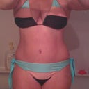 after body lift, I can finally really see the definition in my abs.