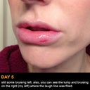 Day 5