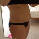 Before pic 1