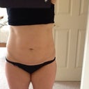 Before pic 2