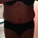 3 weeks post-op