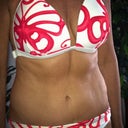 One Year Post-op