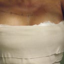 this is the best i could the day after surgery. all wrpped up & no place to go!