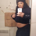 Friday Feb 22,2013 I had to remind myself HEY TODAY IS YOUR ANNIVERSARY!!!Its the middle of winter Yeah I gained about 10lbs since my TT but I will lose it as I do every spring however my tummy is still flat exactly 2 years later! What do you think?!?